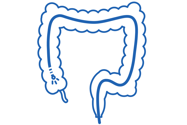STEP4. 腸内を観察